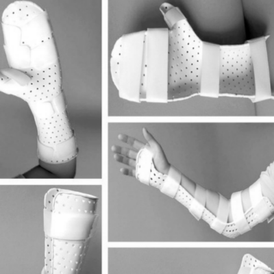 gOctqQ23TuyRE4xiyS2dxg_副本 Polycaprolactone (PCL)